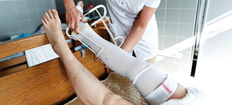 κάλτσες συμπίεσης για τη θεραπεία των κιρσών